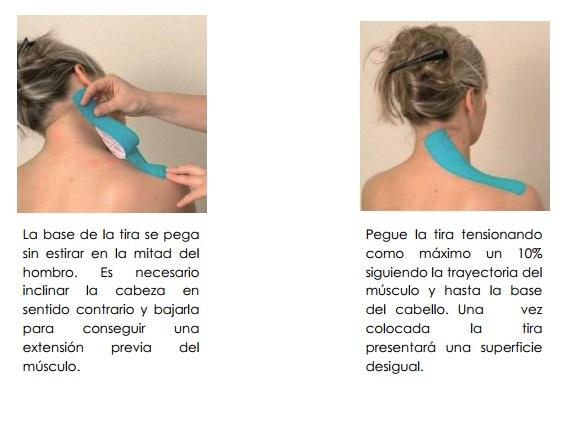 kinesiotape_ejemplo_1