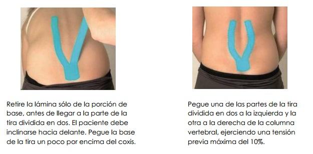 kinesiotape_ejemplo_2