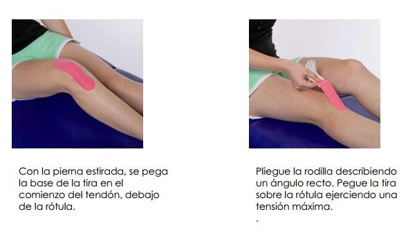 kinesiotape_ejemplo_3