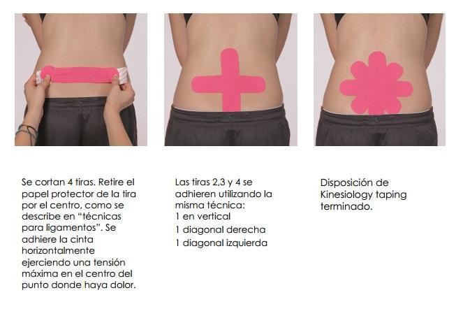 kinesiotape_ejemplo_4