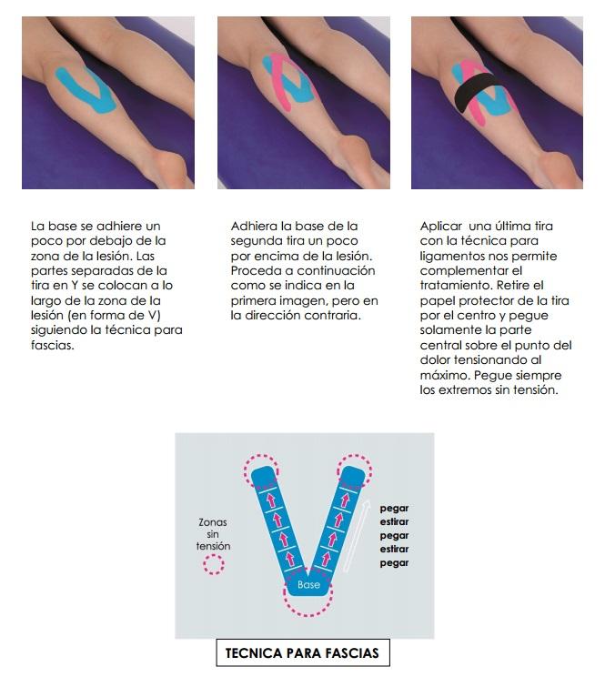 kinesiotape_ejemplo_5
