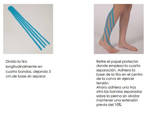 kinesiotape_ejemplo_7