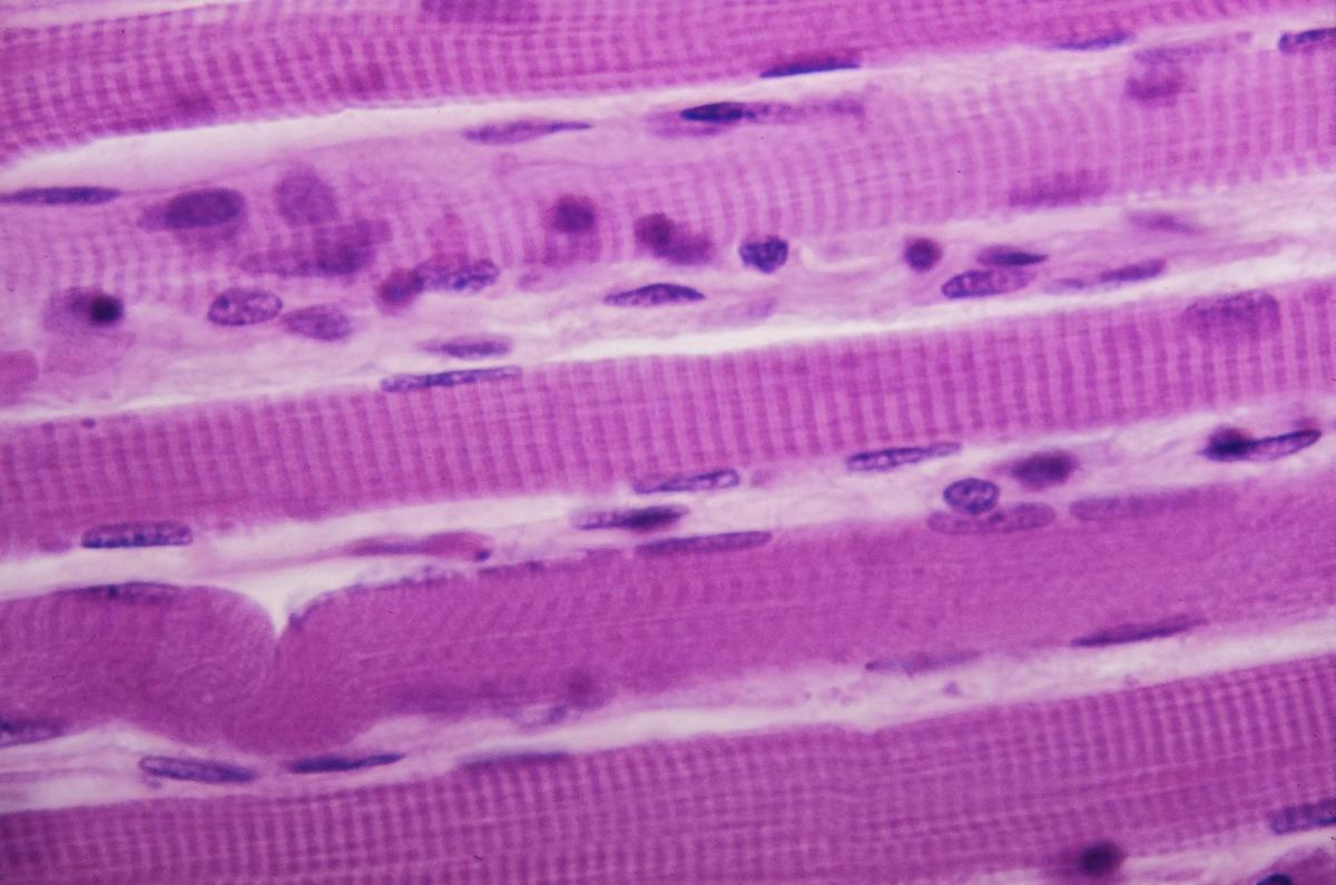 fibra muscular microscopio