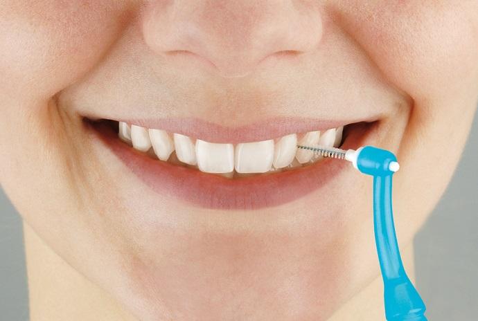 pacientes especiales madrid cepillo interproximal