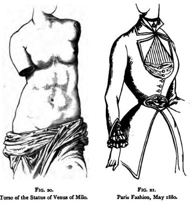 peligros fajas colombianas reductoras