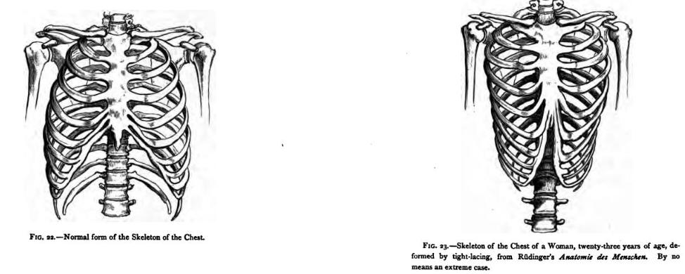 funcionan las fajas colombianas