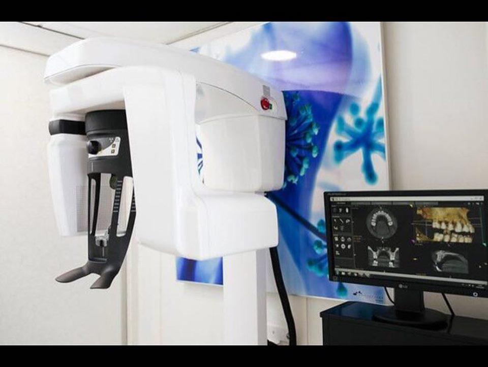 Blanqueamiento dental