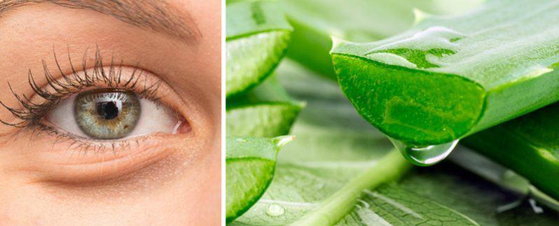 remedios para las ojeras oscuras