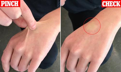 deshidratación en ancianos y personas mayores, signos y síntomas