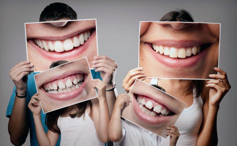 Tratamientos más comunes de estética dental