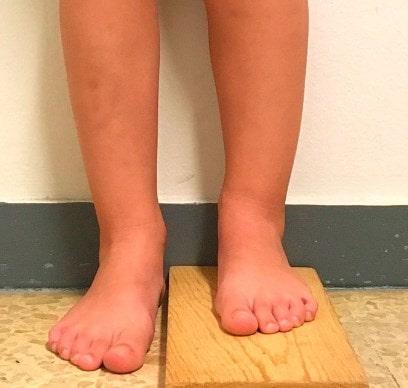 Complicaciones de la cirugía 