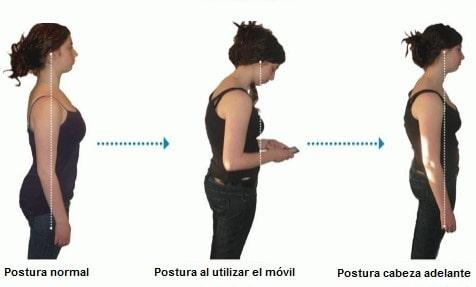 Cómo prevenir la aparición de la joroba