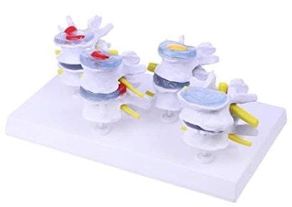 disco intervertebral en PVC