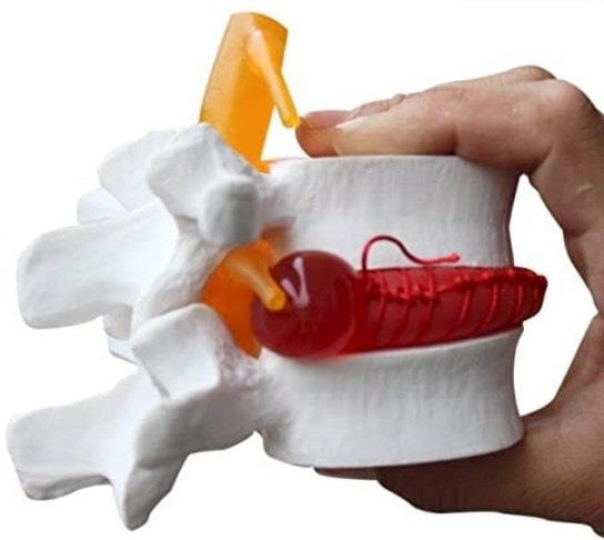 disco con elastómero