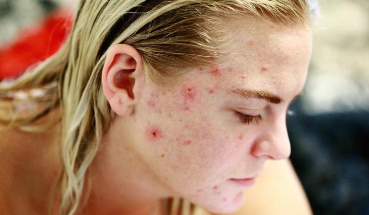 cómo preparar la chia