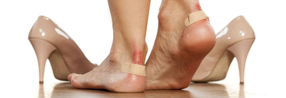 rozaduras en el talón