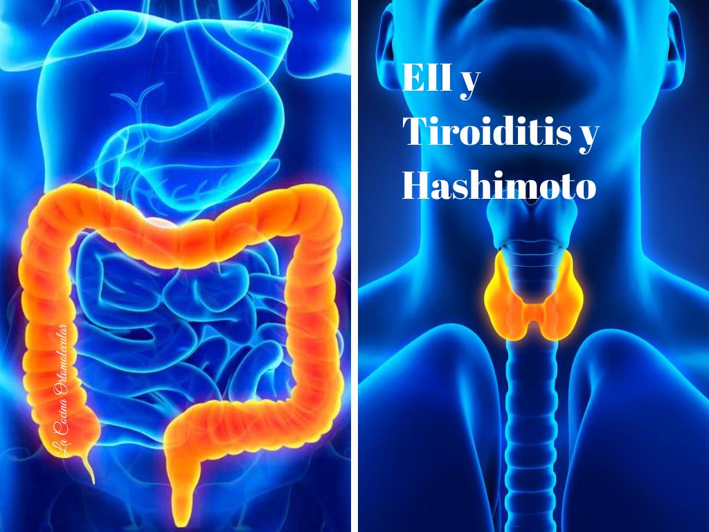 DPA y enfermedad inflamatoria intestinal y Tiroiditis de Hashimoto - La Cocina Ortomolecular