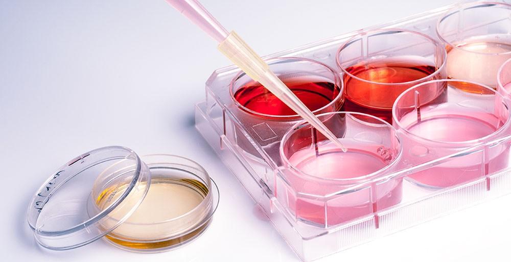 análisis de sangre embarazo