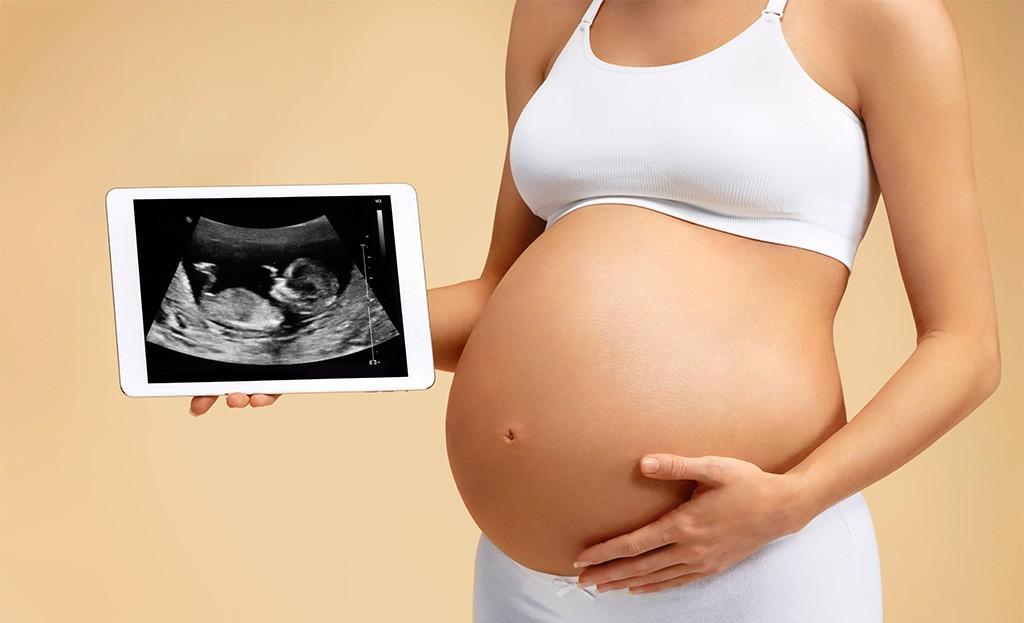 ecografía 4D bebé semana 29 de embarazo