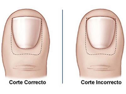 cortar correctamente las uñas