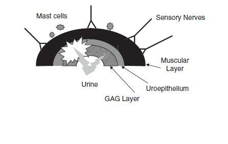 Esquema de la vejiga de gatos afectados con CIF, que muestra la pérdida de la integridad de la capa de GAGs. (Hostutler et al)