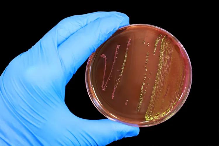 bacterias escherichia coli alimentos riesgo cómo tratar para prevenir infecciones