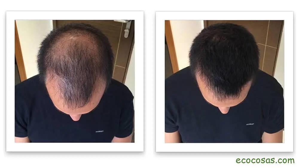 aceite de ricino en el pelo