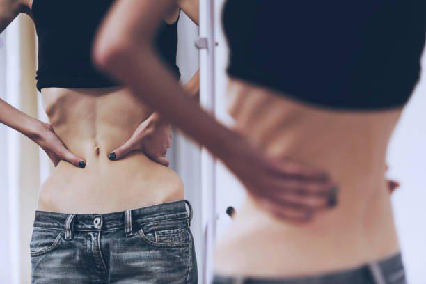 la anorexia y la bulimia 