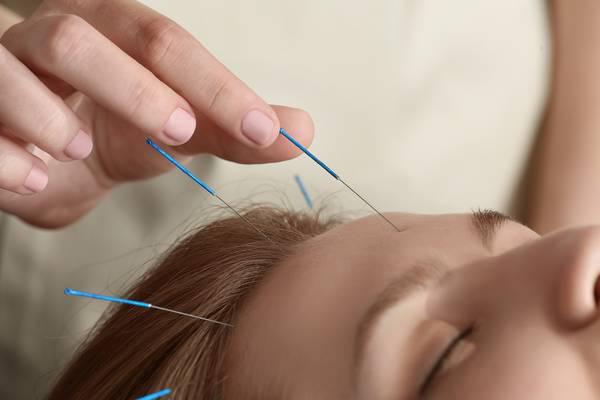 La acupuntura es uno de los mejores tratamientos para las arrugas profundas de la frente.