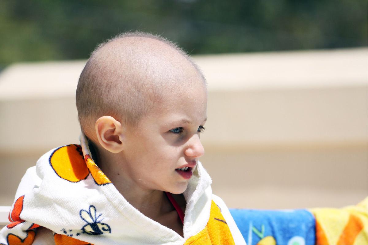 alopecia nerviosa infantil 
