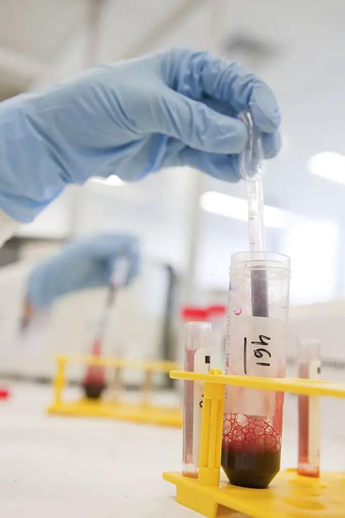 Investigaciones con células madre