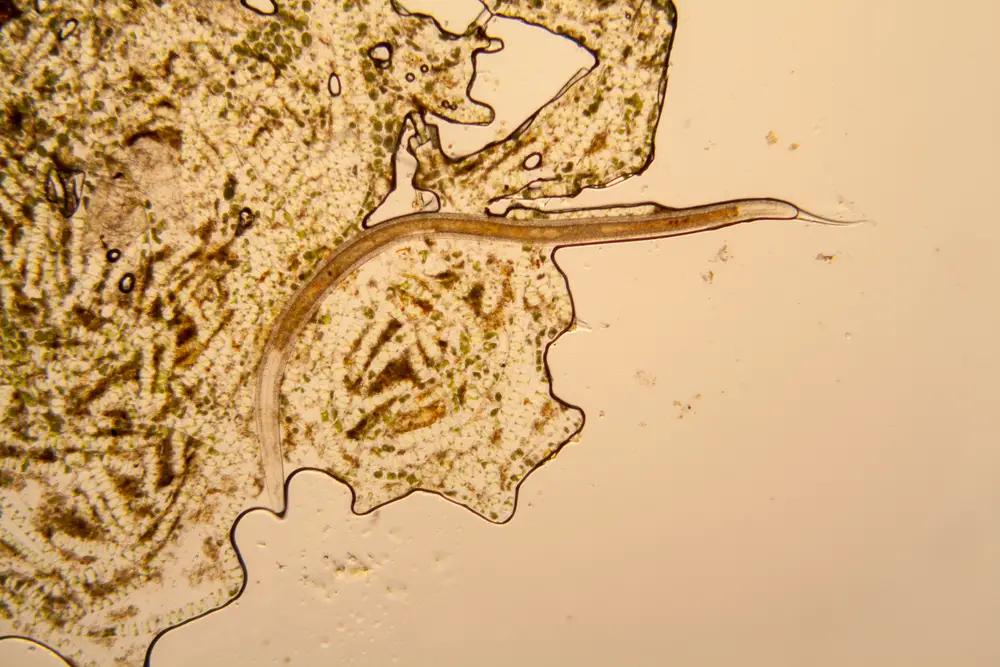 neorickettsia helminthoeca al microscopio