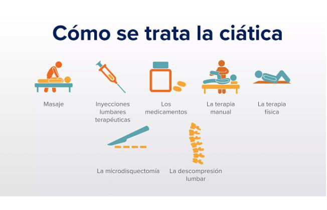 dolor de ciatica