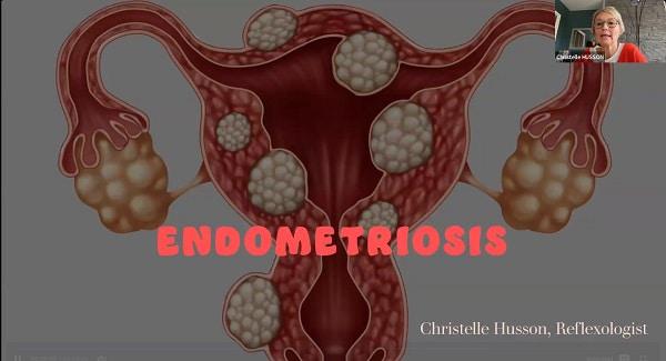 Reflexologia y endometriosis