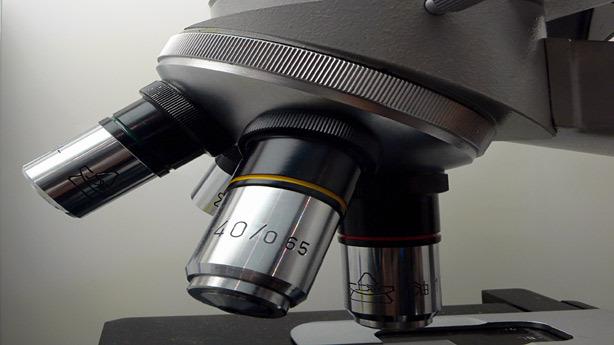 Dieta Dukan ¿peligrosa para los riñones?