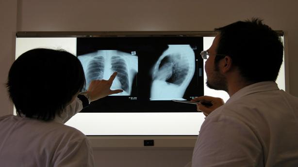 Dieta Dukan ¿peligrosa para los riñones?