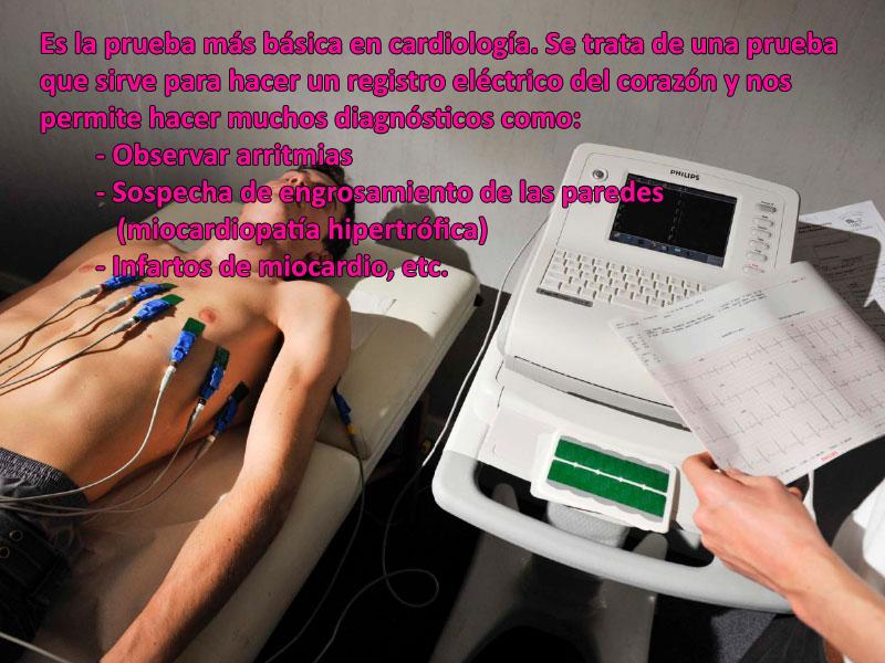 electrocardiograma copia