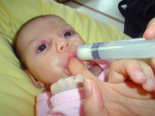 Técnica de suplementación con leche materna extraía "dedo-jeringa"