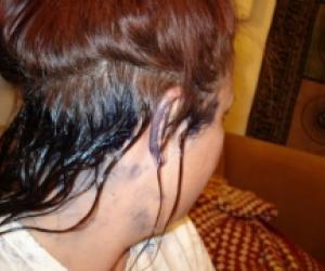 Hair Dye Stain Removal