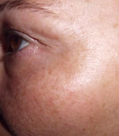 mascarilla facial al limon