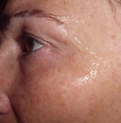 mascarilla facial en gel