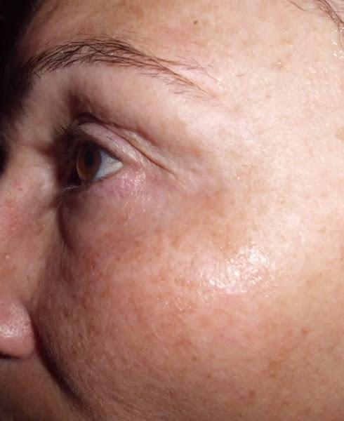 mascarilla facial peeling 