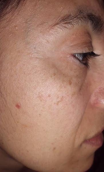 piel con manchas