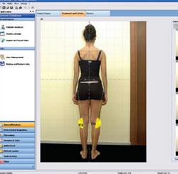 baro 4 Baropodometría. Cuida tus pies