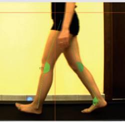 baro 6 Baropodometría. Cuida tus pies