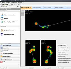baro 1 Baropodometría. Cuida tus pies