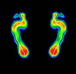 baro 3 Baropodometría. Cuida tus pies