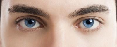 Ojos alopecia en las cejas