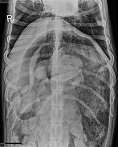 Un Perro Se Come 43 Calcetines y Sobrevive