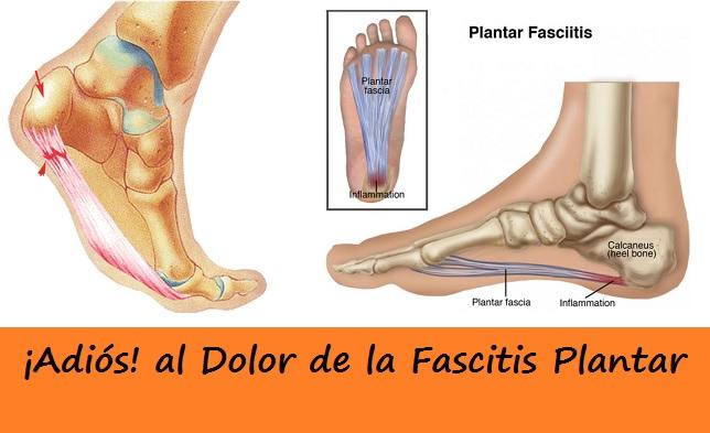 Fascitis Plantar Fascitis Plantar ¿Qué es? y Ejercicios para Evitar el Dolor
